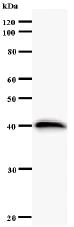Western blot - Anti-DNA helicase HEL308 antibody [2406C1a] (AB54399)
