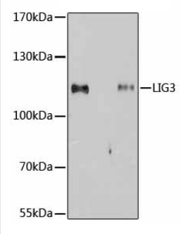 Immunoprecipitation - Anti-DNA Ligase III/LIG3 antibody (AB185815)