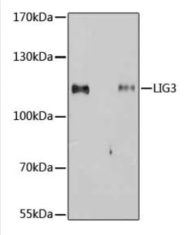 Immunoprecipitation - Anti-DNA Ligase III/LIG3 antibody (AB185815)