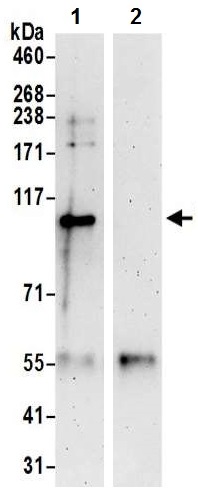 Immunoprecipitation - Anti-DNA Ligase III/LIG3 antibody (AB224820)