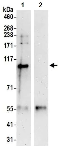 Immunoprecipitation - Anti-DNA Ligase III/LIG3 antibody (AB224820)