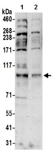 Western blot - Anti-DNA Ligase III/LIG3 antibody (AB224820)