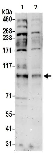 Western blot - Anti-DNA Ligase III/LIG3 antibody (AB224820)