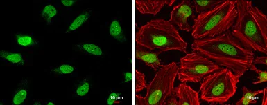 Immunocytochemistry/ Immunofluorescence - Anti-DNA Ligase III/LIG3 antibody (AB96576)