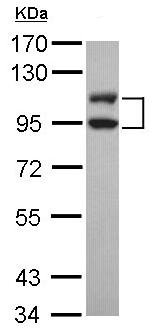 Western blot - Anti-DNA Ligase III/LIG3 antibody (AB97404), expandable thumbnail