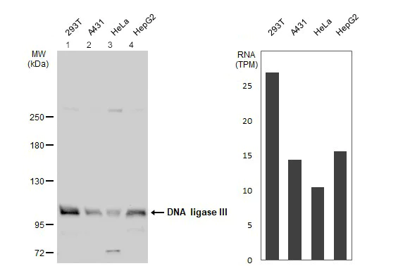 Western blot - Anti-DNA Ligase III/LIG3 antibody (AB97404)