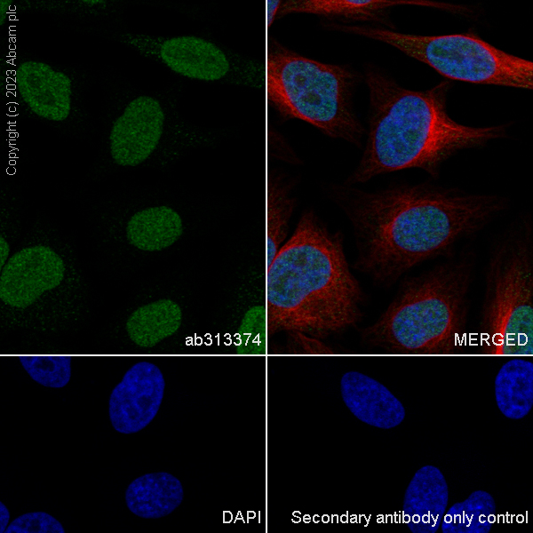 Immunocytochemistry/ Immunofluorescence - Anti-DNA Ligase III/LIG3 antibody [EPR27265-44] - BSA and Azide free (AB313375), expandable thumbnail