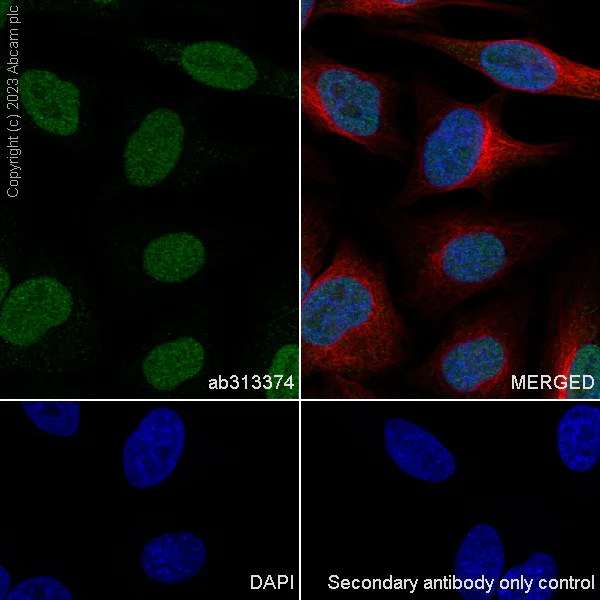 Immunocytochemistry/ Immunofluorescence - Anti-DNA Ligase III/LIG3 antibody [EPR27265-44] - BSA and Azide free (AB313375)