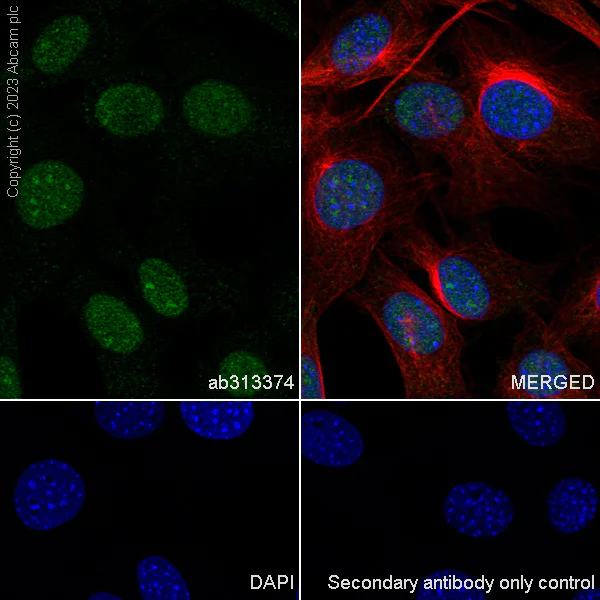 Immunocytochemistry/ Immunofluorescence - Anti-DNA Ligase III/LIG3 antibody [EPR27265-44] - BSA and Azide free (AB313375)