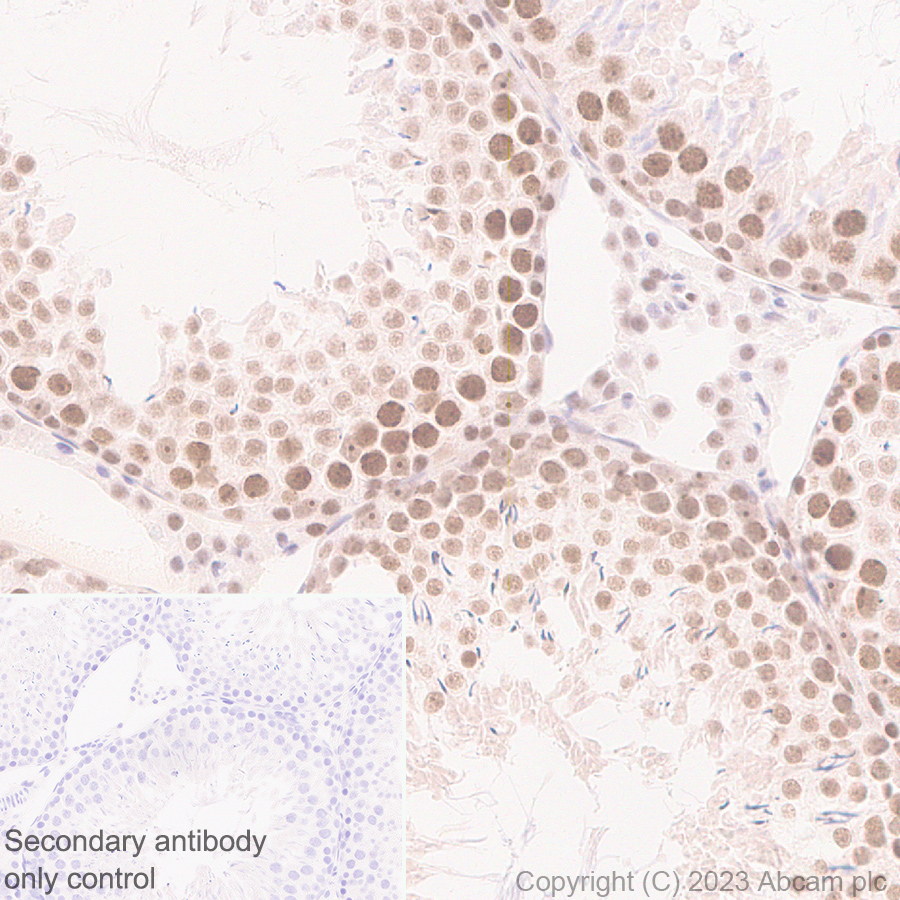 Immunohistochemistry (Formalin/PFA-fixed paraffin-embedded sections) - Anti-DNA Ligase III/LIG3 antibody [EPR27265-44] - BSA and Azide free (AB313375), expandable thumbnail