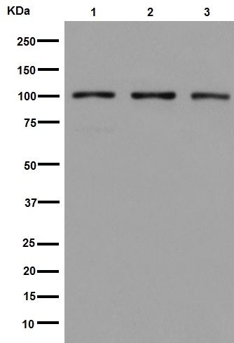 Western blot - Anti-DNA Ligase IV/LIG4 antibody [EPR16531] (AB193353)