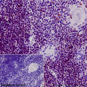 Immunohistochemistry (Formalin/PFA-fixed paraffin-embedded sections) - Anti-DNA Ligase IV/LIG4 antibody [EPR16531] - BSA and Azide free (AB232658)
