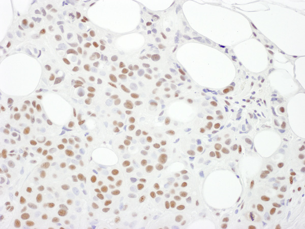 Immunohistochemistry (Formalin/PFA-fixed paraffin-embedded sections) - Anti-DNA PKcs antibody (AB168854)