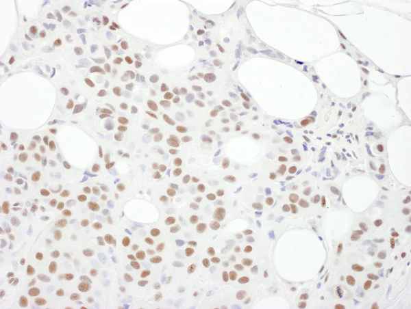 Immunohistochemistry (Formalin/PFA-fixed paraffin-embedded sections) - Anti-DNA PKcs antibody (AB168854)