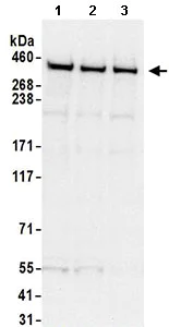 Western blot - Anti-DNA PKcs antibody (AB168854)