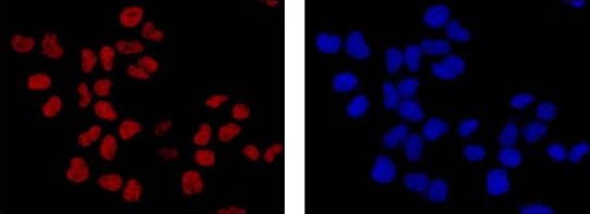 Immunocytochemistry/ Immunofluorescence - Anti-DNA PKcs antibody [Y393] (AB32566), expandable thumbnail