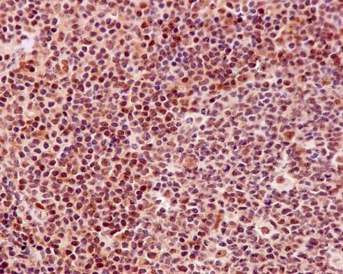 Immunohistochemistry (Formalin/PFA-fixed paraffin-embedded sections) - Anti-DNA PKcs antibody [Y393] (ab32566), expandable thumbnail