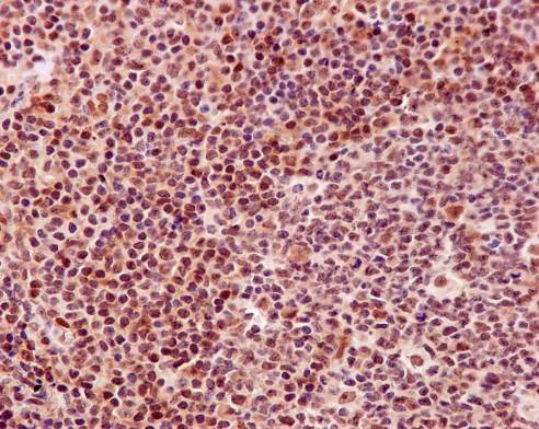 Immunohistochemistry (Formalin/PFA-fixed paraffin-embedded sections) - Anti-DNA PKcs antibody [Y393] (AB32566)