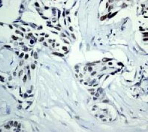 Immunohistochemistry (Formalin/PFA-fixed paraffin-embedded sections) - Anti-DNA PKcs antibody [Y393] (ab32566), expandable thumbnail