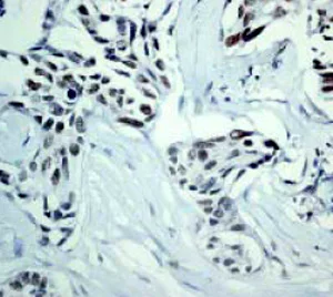 Immunohistochemistry (Formalin/PFA-fixed paraffin-embedded sections) - Anti-DNA PKcs antibody [Y393] (AB32566)