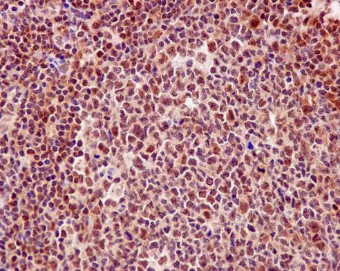 Immunohistochemistry (Formalin/PFA-fixed paraffin-embedded sections) - Anti-DNA PKcs antibody [Y393] - BSA and Azide free (AB174575)