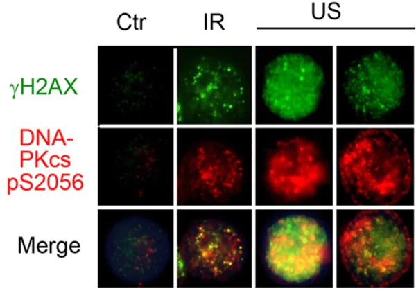 Immunocytochemistry/ Immunofluorescence - Anti-DNA PKcs (phospho S2056) antibody (AB18192)