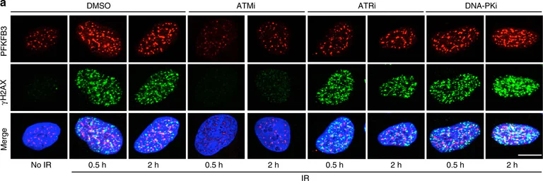 Immunocytochemistry/ Immunofluorescence - Anti-DNA PKcs (phospho S2056) antibody (AB18192)