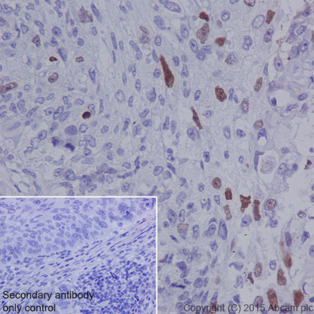 Immunohistochemistry (Formalin/PFA-fixed paraffin-embedded sections) - Anti-DNA PKcs (phospho S2056) antibody [EPR5670] (AB124918), expandable thumbnail