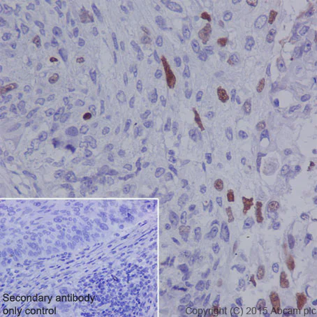 Immunohistochemistry (Formalin/PFA-fixed paraffin-embedded sections) - Anti-DNA PKcs (phospho S2056) antibody [EPR5670] (AB124918)