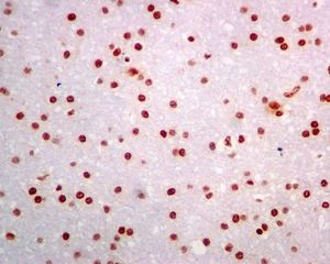 Immunohistochemistry (Formalin/PFA-fixed paraffin-embedded sections) - Anti-DNA PKcs (phospho S2056) antibody [EPR5670] (AB124918), expandable thumbnail