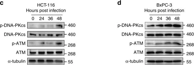 Western blot - Anti-DNA PKcs (phospho S2056) antibody [EPR5670] (AB124918)