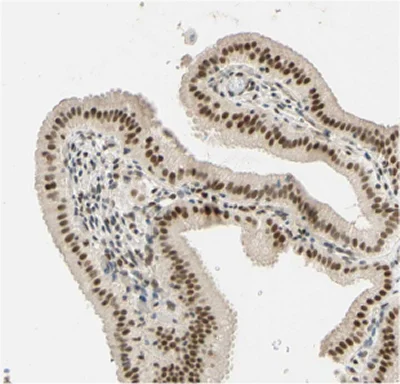 Immunohistochemistry (Formalin/PFA-fixed paraffin-embedded sections) - Anti-DNA Polymerase beta antibody (AB26343)