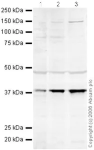 Western blot - Anti-DNA Polymerase beta antibody (AB26343)