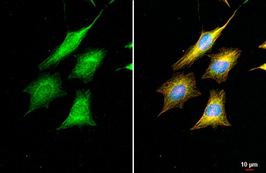 Immunocytochemistry/ Immunofluorescence - Anti-DNA polymerase beta antibody [HL1512] (AB308159)