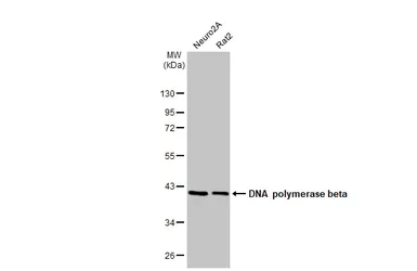 Western blot - Anti-DNA polymerase beta antibody [HL1512] (AB308159)