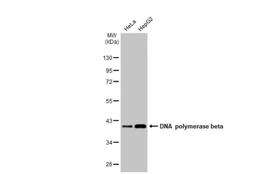 Western blot - Anti-DNA polymerase beta antibody [HL1512] (AB308159)