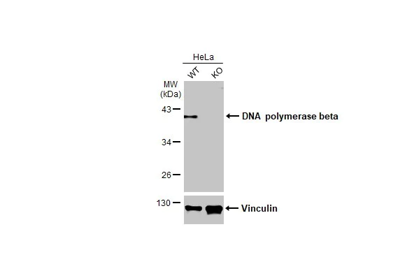 Western blot - Anti-DNA polymerase beta antibody [HL1512] (AB308159)