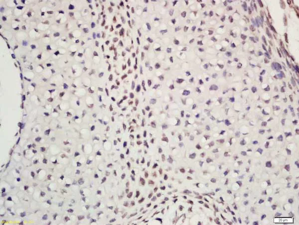 Immunohistochemistry (Formalin/PFA-fixed paraffin-embedded sections) - Anti-DNA Polymerase epsilon p59 antibody (AB203091)