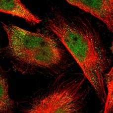 Immunocytochemistry/ Immunofluorescence - Anti-DNA polymerase eta antibody (AB186677)