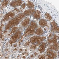 Immunohistochemistry (Formalin/PFA-fixed paraffin-embedded sections) - Anti-DNA polymerase eta antibody (AB186677)