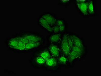 Immunocytochemistry/ Immunofluorescence - Anti-DNA polymerase eta antibody (AB234855)