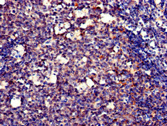 Immunohistochemistry (Formalin/PFA-fixed paraffin-embedded sections) - Anti-DNA polymerase eta antibody (AB234855)