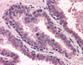 Immunohistochemistry (Formalin/PFA-fixed paraffin-embedded sections) - Anti-DNA Polymerase Kappa/POLK antibody (AB115625)