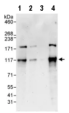 Western blot - Anti-DNA Polymerase Kappa/POLK antibody (AB86076)