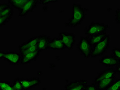 Immunocytochemistry/ Immunofluorescence - Anti-DNA Polymerase lambda antibody (AB236985)