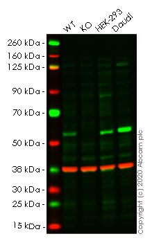 Western blot - Anti-DNA polymerase mu antibody [EPR10470(B)] (AB157465)