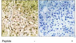 Immunohistochemistry (Formalin/PFA-fixed paraffin-embedded sections) - Anti-DNA Polymerase theta antibody (AB111218)
