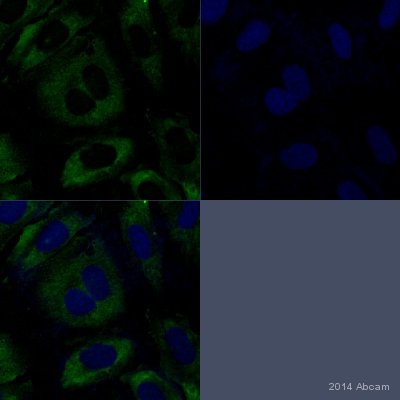 Immunocytochemistry - Anti-DNA/RNA Damage antibody [15A3] (AB62623)