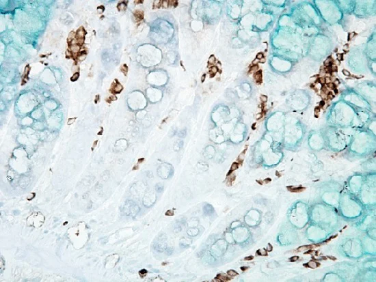 Immunohistochemistry (Formalin/PFA-fixed paraffin-embedded sections) - Anti-DNA/RNA Damage antibody [15A3] (AB62623)