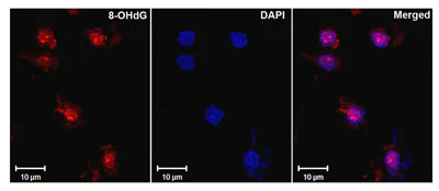 Immunohistochemistry (Formalin/PFA-fixed paraffin-embedded sections) - Anti-DNA/RNA Damage antibody [15A3] (AB62623)